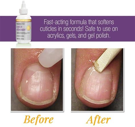 Cuticle Remover Before And After