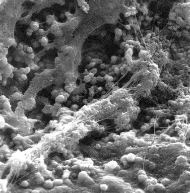 Em Evaluation Of Bacterial Biofilm And Microorganisms On The Apical