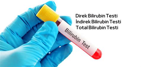 Bilirubin Testi Nedir Nasıl Yapılır Fiyatı Nedir Tetra Laboratuvar