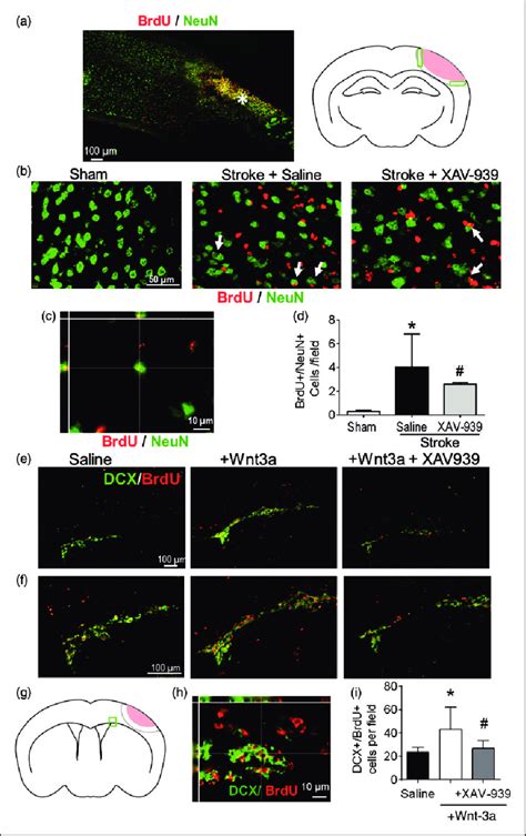 The Role Of The Wnt Signaling Pathway In Neurogenesis After Stroke