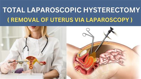 Total Laparoscopic Hysterectomy Removal Of Uterus Via Laparoscopy