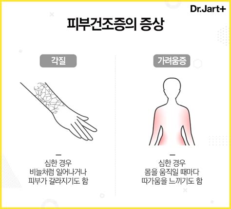 Q ‘피부건조증의 증상은 무엇이고 어떻게 관리해야 할까요 네이버 포스트