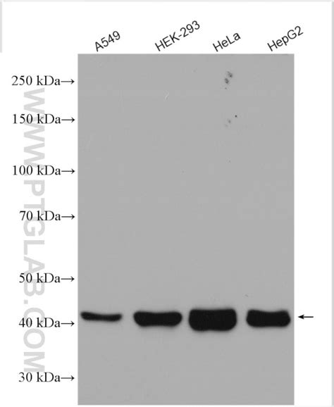 Hla Class I Abc Polyclonal Antibody 15240 1 Ap