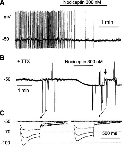 Inhibition Of Tmn Histaminergic Neuron By Nociceptin A Depression Of