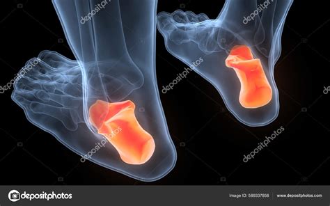 Human Skeleton System Calcaneus Bone Joints Anatomy Stock Photo By