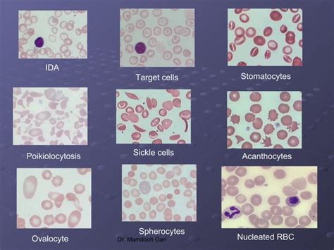 2 classification of anemia | PPT