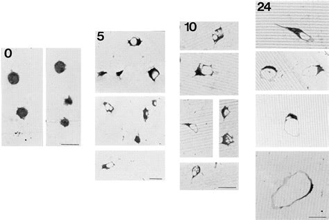 Rgd Dependent Vacuolation And Lumen Formation Observed During Endothelial Cell Morphogenesis In