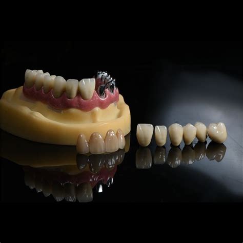 China Pfm Ceramic Crowns Manufacturers Suppliers Factory Low Price