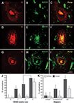 Frontiers ROCK1 Is Associated With Alzheimers Disease Specific