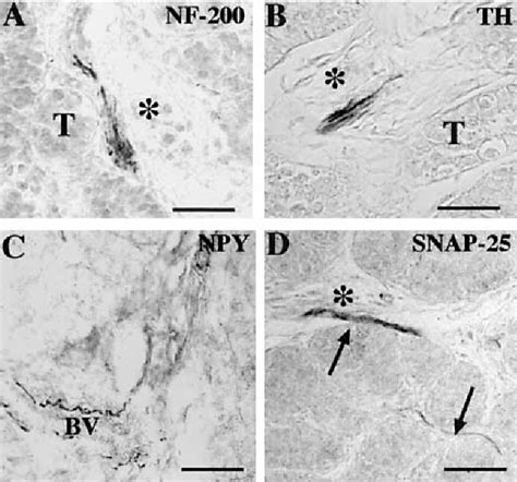 Figure 1 From Neuronal Elements In The Testis Of The Rhesus Monkey