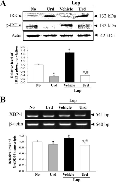 Expression of marker proteins in IRE1α XBP pathway A The expression