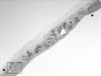 Representative Photomicro Graph Of Defect Site Receiving The