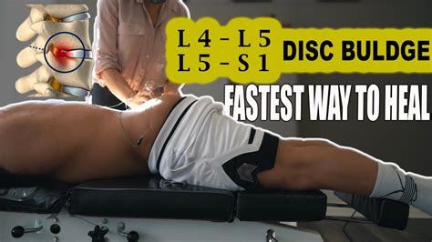 Herniated Disc Rehab How To Recover Quickly And Reduce Your Pain Pt1