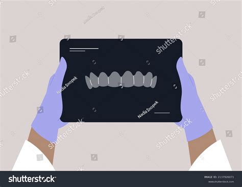 Doctor Holding Xray Teeth Scan Dentist Stock Vector Royalty Free