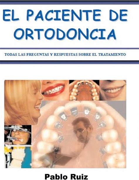 El Paciente De Ortodoncia Ebook Pablo Ruiz Boeken