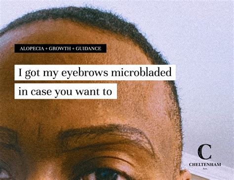 I Got My Eyebrows Micobladed — Cheltenham