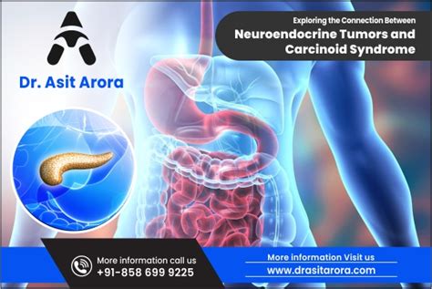 Carcinoid Syndrome Rash