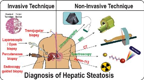 Illustration Of Invasive And Non Invasive Technique Available For The