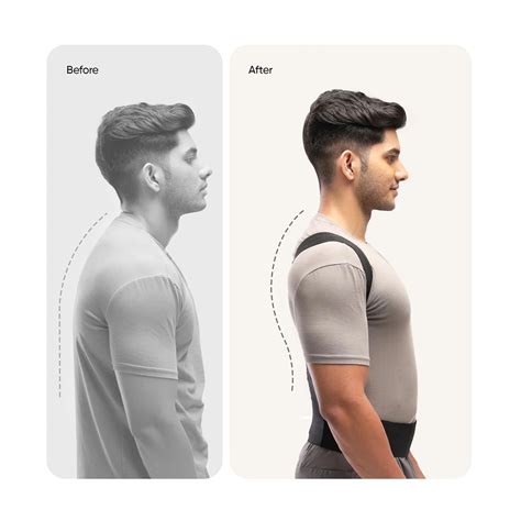 Buy Frido Orthotics Posture Corrector | Posture Corrector – FRIDO