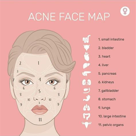 Face Mapping Acne Skin Artofit