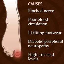 Swirlster First: What Causes Numbness In Big Toe