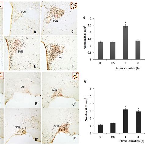 Immunohistochemical Staining Of Fos Ir Neurons In The Pvn And Son