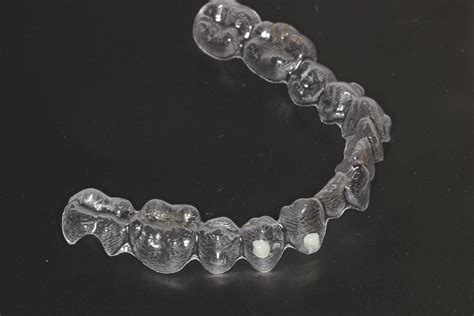 Qu Son Los Ataches De Invisalign Y Para Qu Sirven