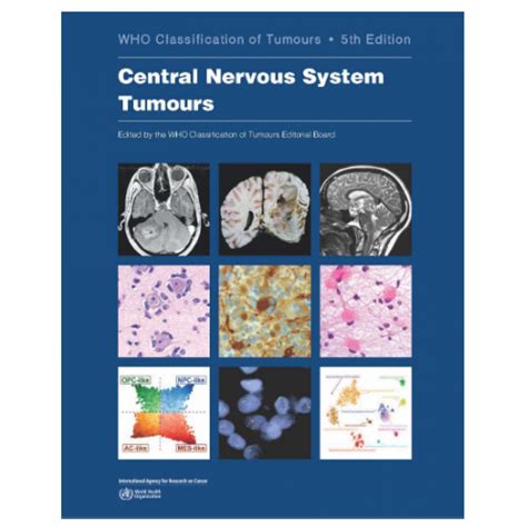 Whos Classification Of Tumours Of The Central Nervous System 5th