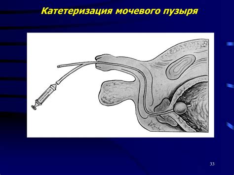 Острая задержка мочи. Гематурия. Острая почечная недостаточность ...