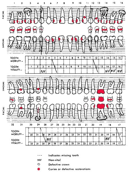 Dental chart | definition of dental chart by Medical dictionary