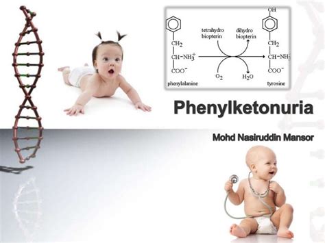 Phenylketonuria