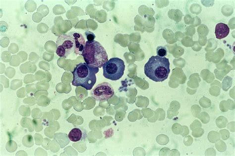 Lm Of A Blood Smear Showing White Blood Cells Photograph by Biophoto ...