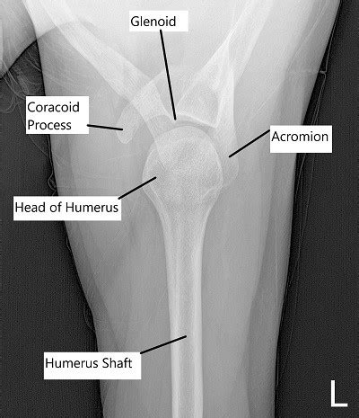 Shoulder Anatomy - Complete Orthopedics & Podiatry | Multiple NY Locations