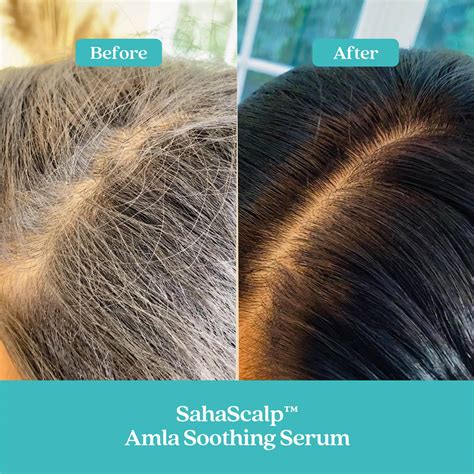 Amla Hair Oil Before And After