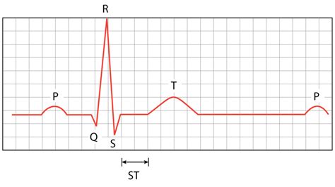 Ekg Diagram Quizlet