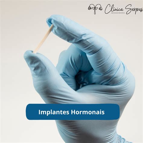 Implantes Hormonais Tipos Duração E Hormônios Principais Clínica Serpas