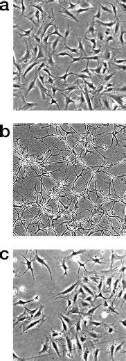 S100A4 Induces Capillary Like Tube Formation In Primary Human