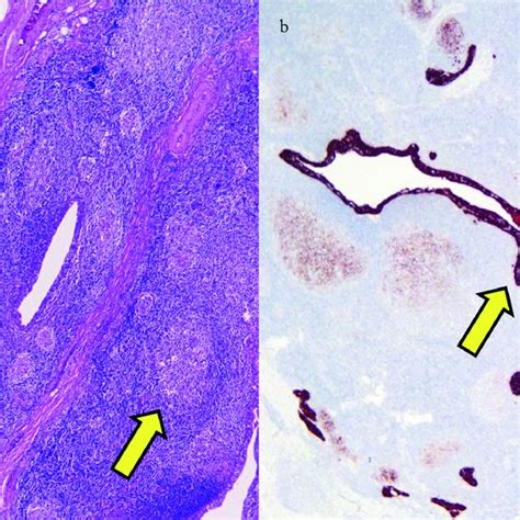 A B Hematoxylin And Eosin And Immunohistochemical Staining With Download Scientific Diagram