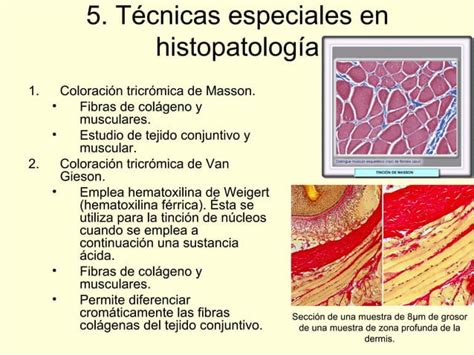 Principales Tinciones En El Laboratorio De Anatomía Patológica