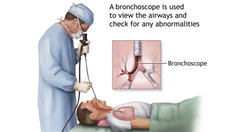 What Is EBUS Interventional Pulmonology In Goa Konkan Dr Prabhu