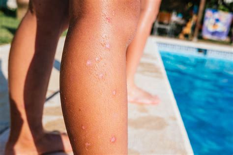 Mosquitos Na Piscina Ou No Jardim Como Se Livrar Deles Tecnyvan Portugal