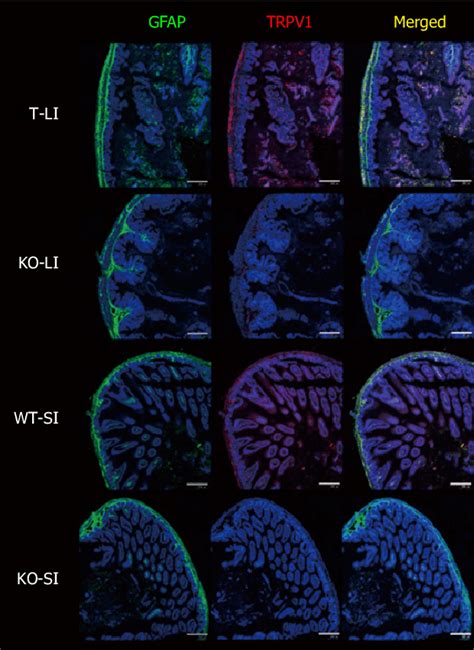 Double Immunostaining With GFAP And TRPV1 Of Small And Large Intestines