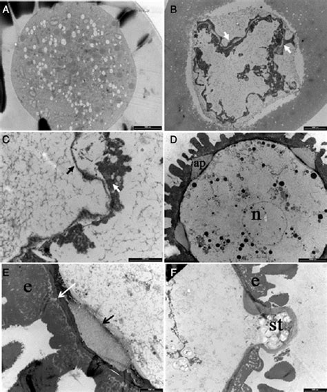 Transmission Electron Micrographs Showing Ultra Structural Features Of