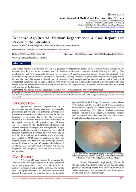 PDF Exudative Age Related Macular Degeneration A Case Report And