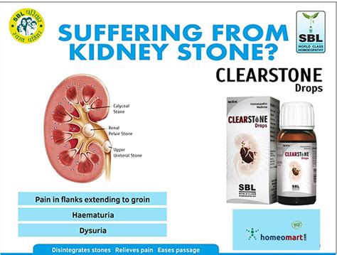 Buy Sbl Clearstone Drops Kidney Stone Relief And Urinary Health Homeomart