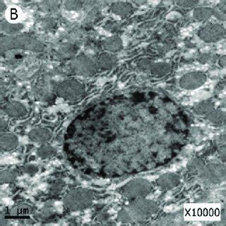 Electron Ultrastructure Of Liver Cell In Control Group A Aspirin