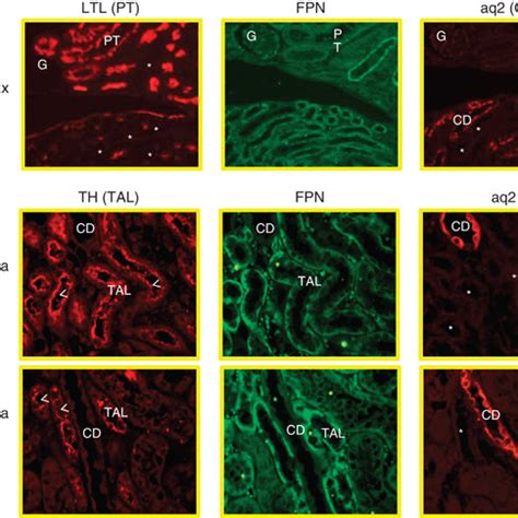 Ferroportin FPN Expression In Hepc Kidneys The MRNA And Protein