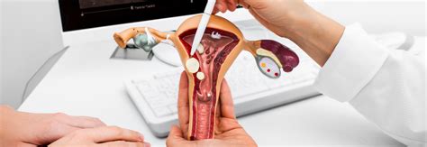 Rak Szyjki Macicy Cytologia Ratuje Ycie Pacjent