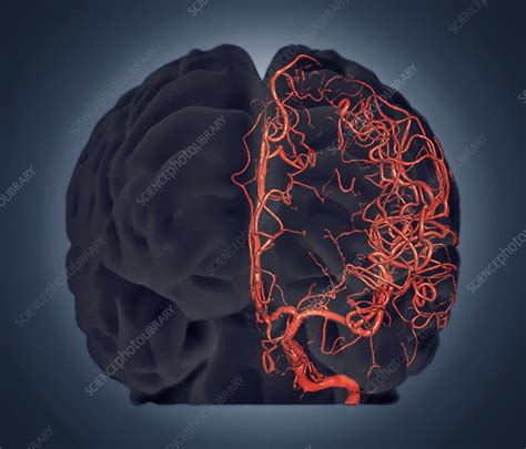 Brain Vascular System 3d Ct Scan Stock Image C0132182 Science