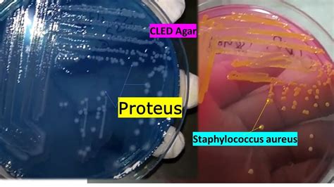 Proteus And Staphylococcus Growth On Cled Agar Demonstration Youtube